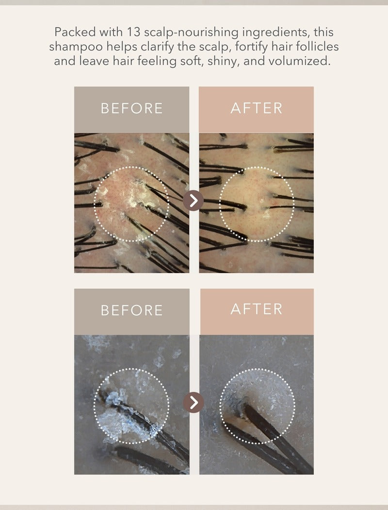 107 Scalp Purifying Microbiome Shampoo (2025 Renewal)
