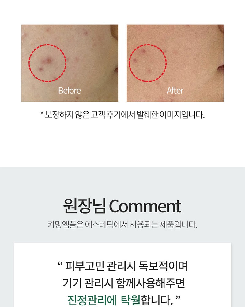 AHOHWA Inten Cure Calming Complex Ampoule 150ml