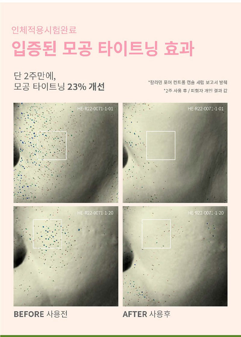 AXIS-Y Calamine Pore Control Capsule Serum