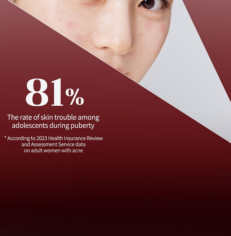 Ariul Expert Azelaic Acid 5% Ampoule