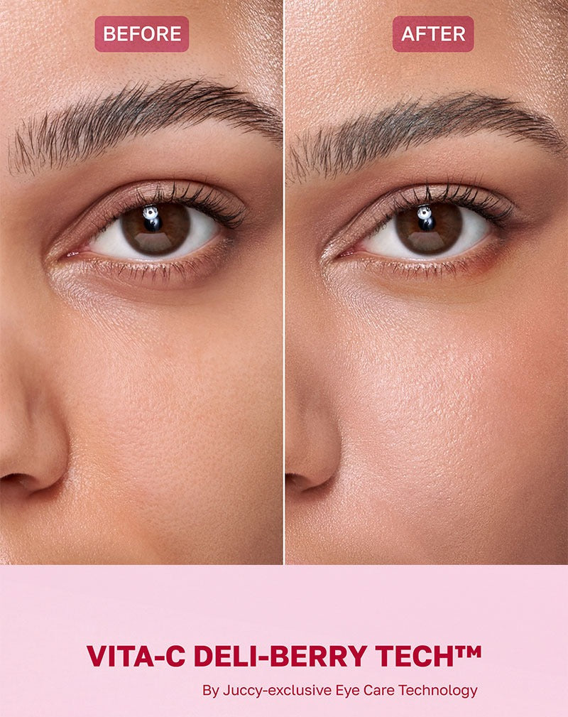 BY JUCCY Gooseberry Dark Circle Brightening Eye Cream 30ml