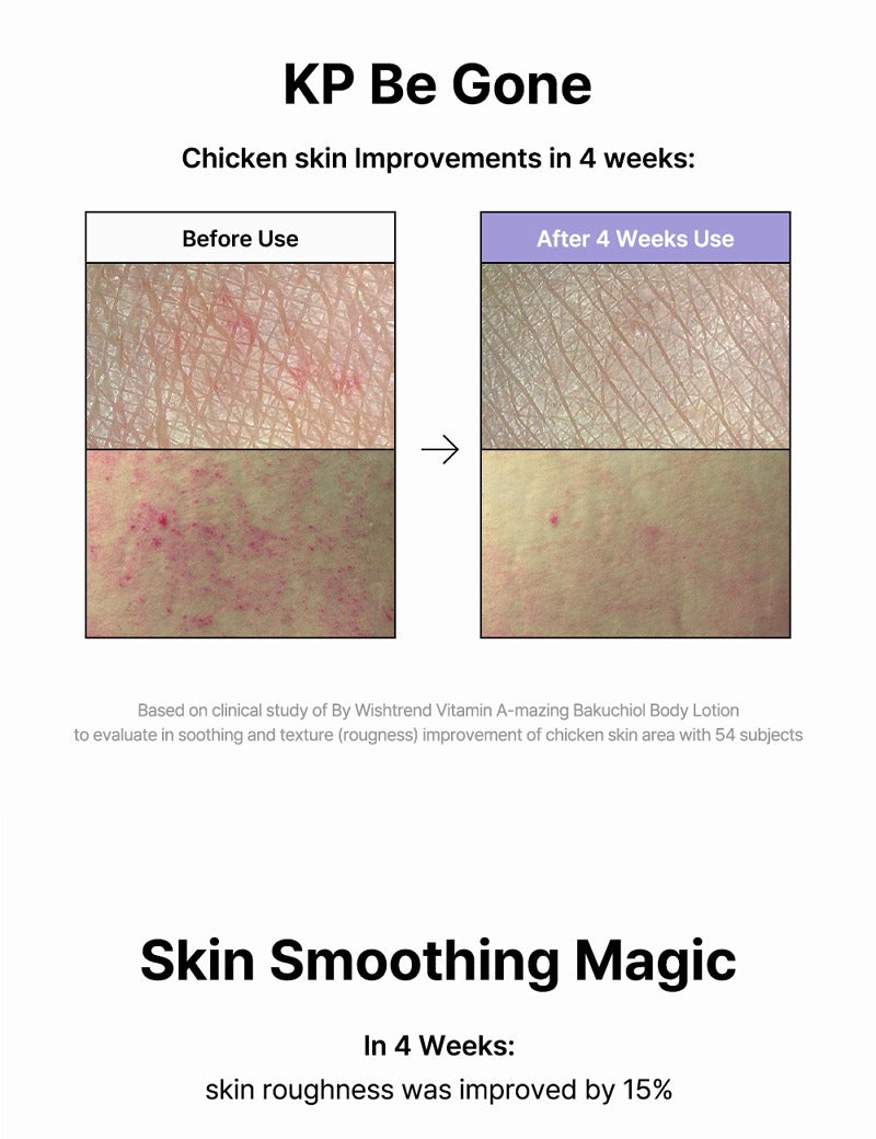 By Wishtrend Vitamin A-mazing Bakuchiol Body Lotion 150g