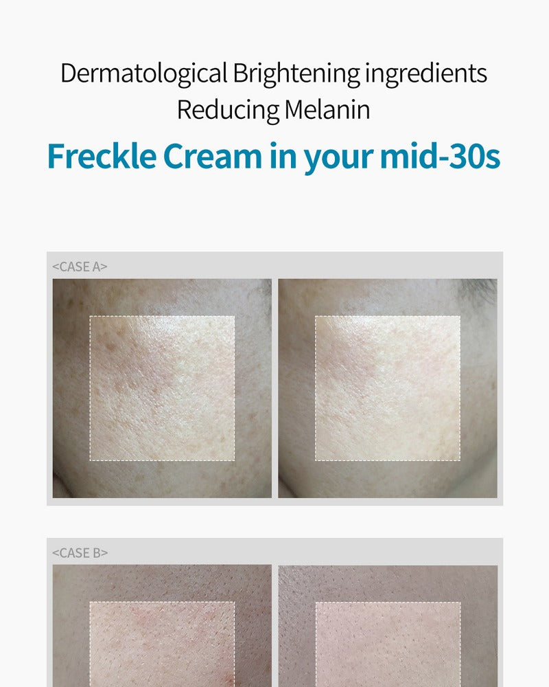 Dr.Melaxin TX Cream 50ml