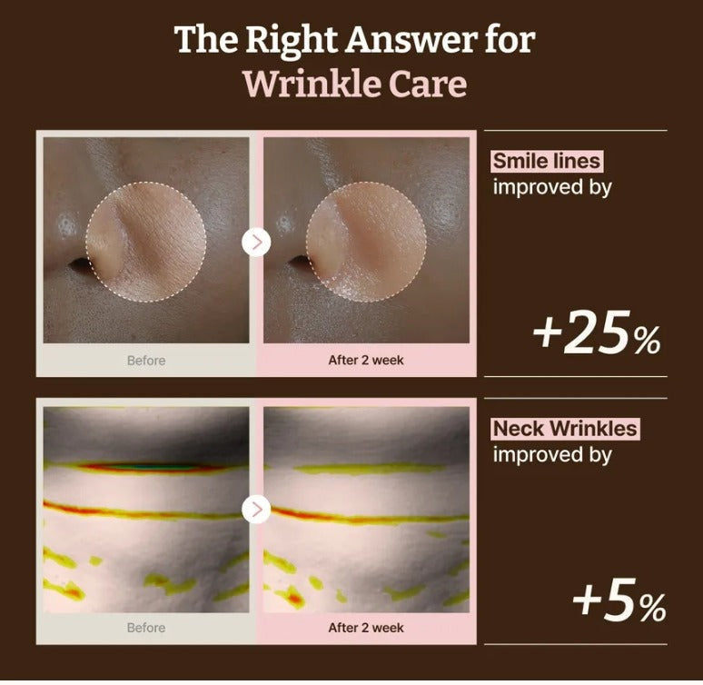 Dr.Reju-All Advanced PDRN Rejuvenating Mask (4ea)