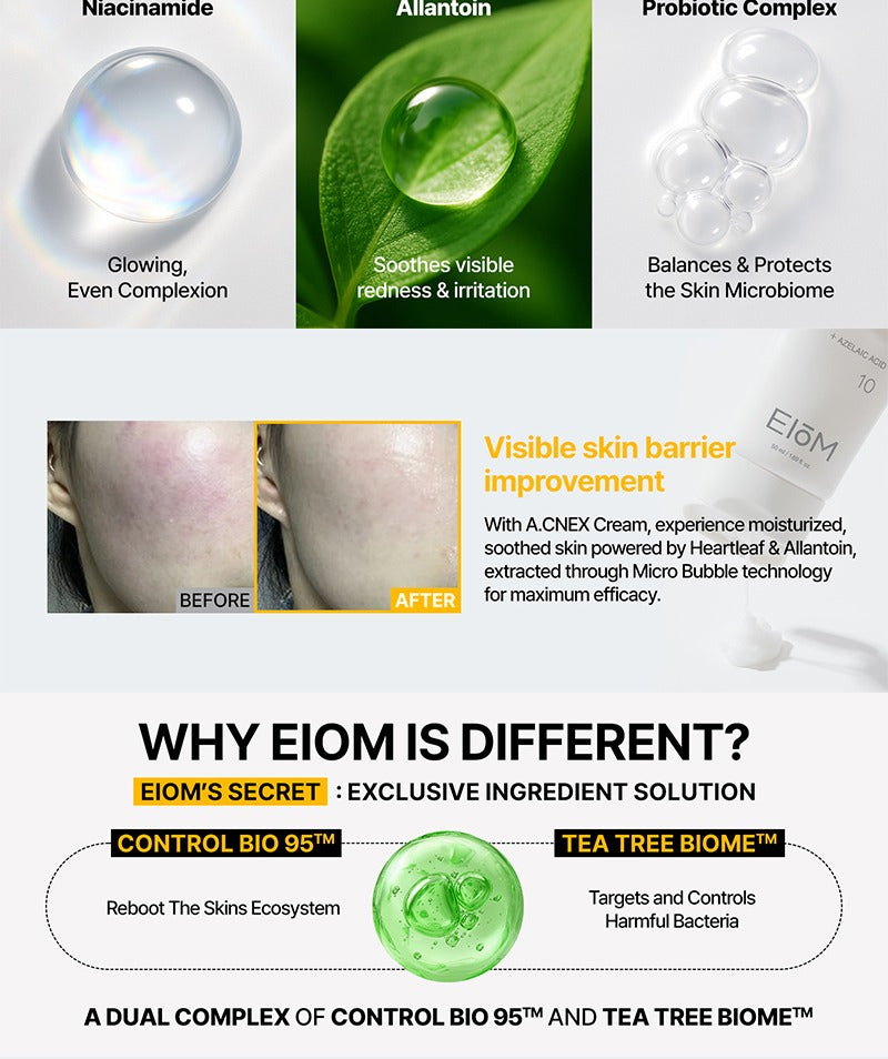 EIOM A.CNEX Cream 50ml
