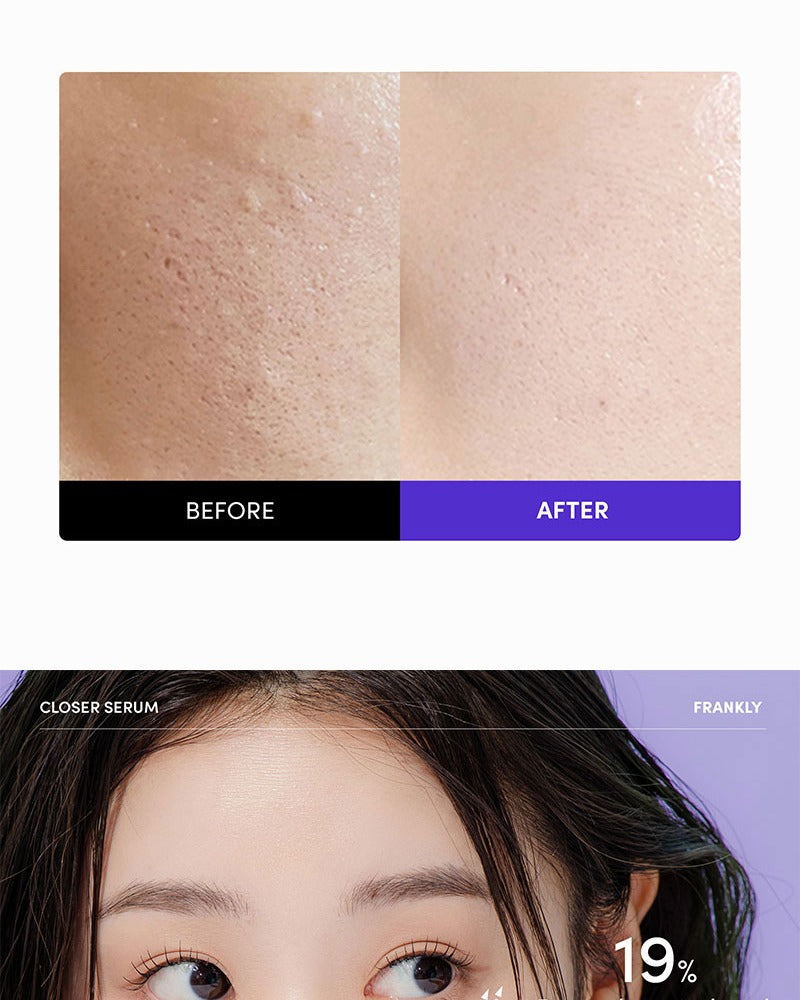 FRANKLY Closer Serum 100ml