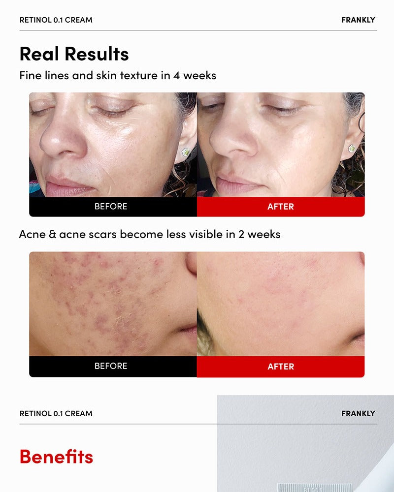 FRANKLY Retinol 0.1% Cream 30ml