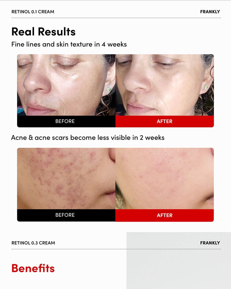 FRANKLY Retinol 0.3% Cream 20ml