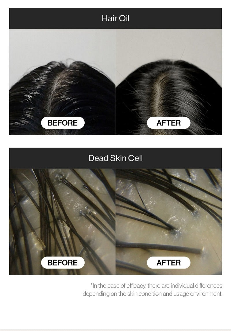 GROWUS Sea Salt Therapy Scalp Scaler 120g