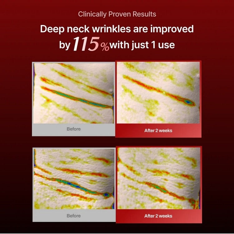 MEDITHERAPY Wrinkle-Fit Needle Roller