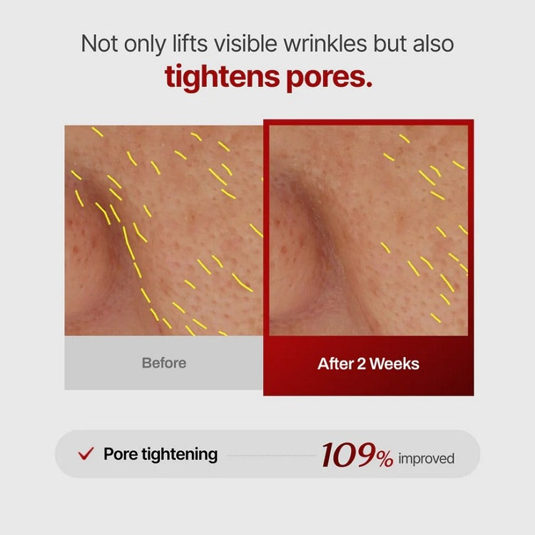 MEDITHERAPY Wrinkle-Fit Needle Roller