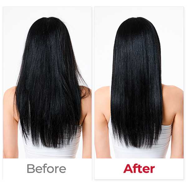 MOEV Annurcatin™ Shampoo 300ml