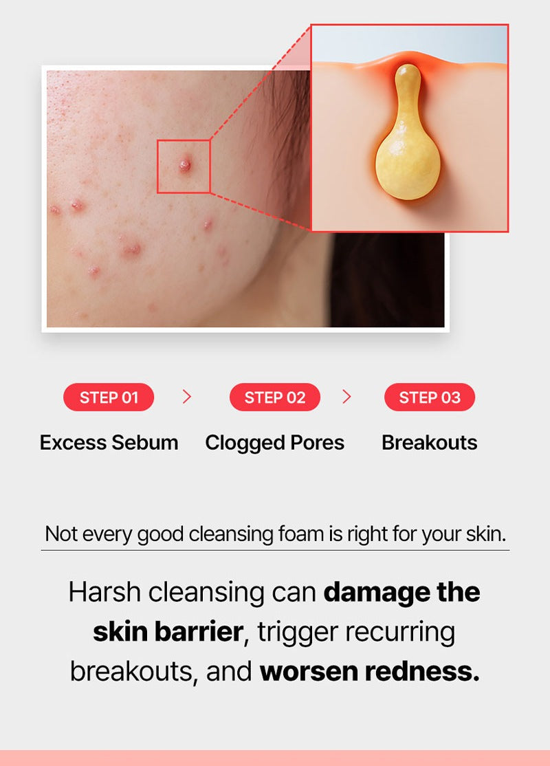 WJ A.Cneed Blemish Red Foam Cleanser 120ml