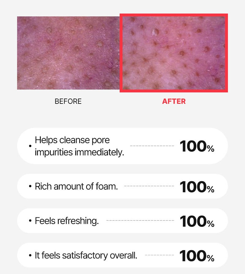 WJ A.Cneed Blemish Red Foam Cleanser 120ml