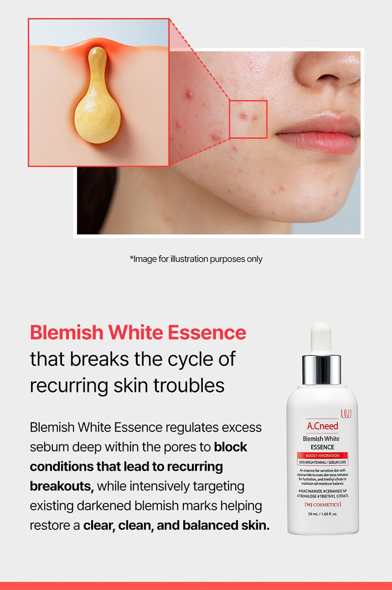 WJ A.Cneed Blemish White Essence 50ml